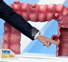 Entrevista   veja como prevenir diagnosticar e tratar a diverticulite, Intestino Preso - Data: 08/09/2014 à Quadro Você e o Doutor - Record