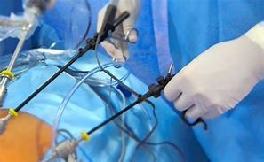 Pólipo e Câncer Colorretal