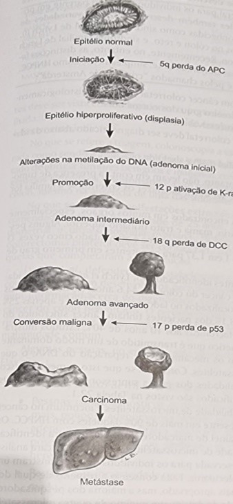 Pólipo e Câncer Colorretal